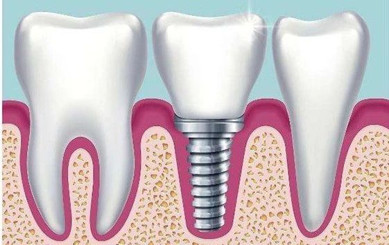 134846_765541_gsdt.jpg 134846_765541_gsdt.jpg